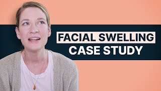 Facial Swelling Case Study for Nurse Practitioners