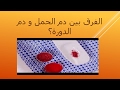 الفرق بين دم الحمل و دم الدورة؟. ثقف نفسك