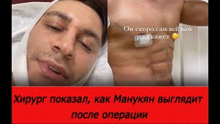 Хирург показал, как выглядит Манукян после операции. /новости/Дава/Ольга Бузова