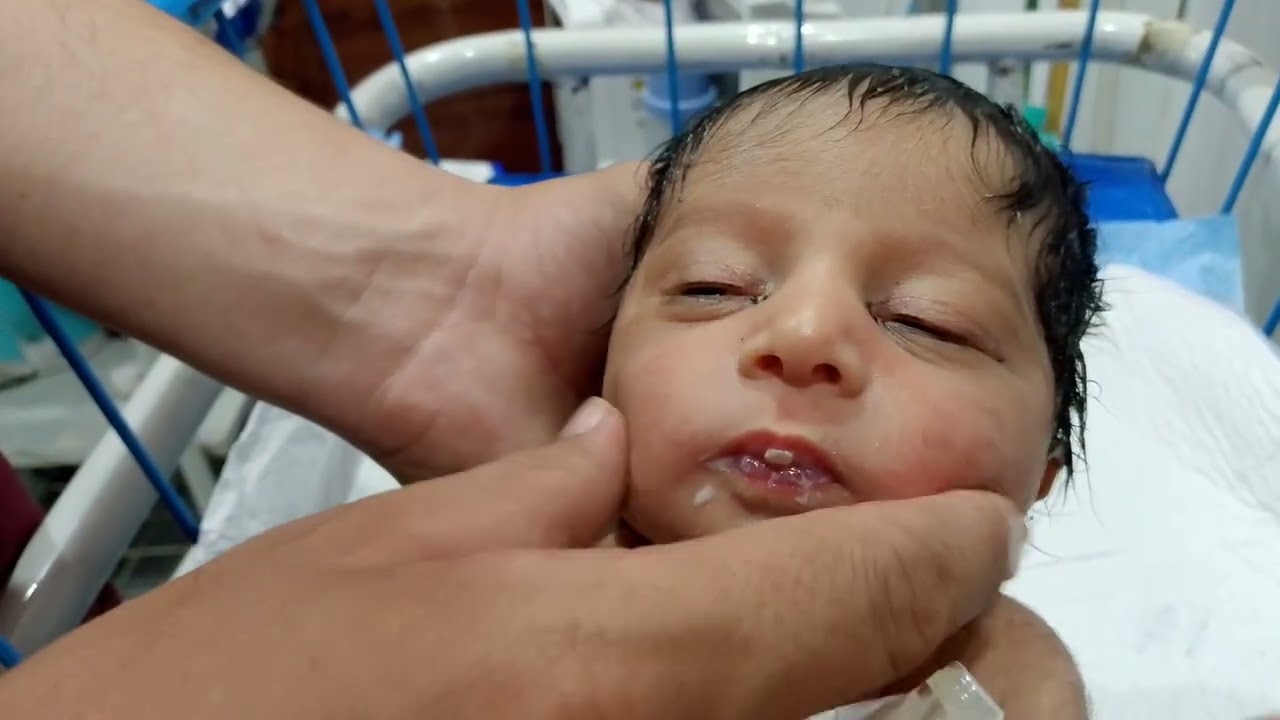 Cute Baby Syringe Feeding Moment💉😍