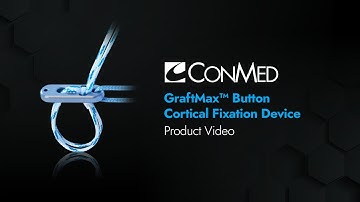 GraftMax™ Button Adjustable Cortical Fixation Device - CONMED Product Video