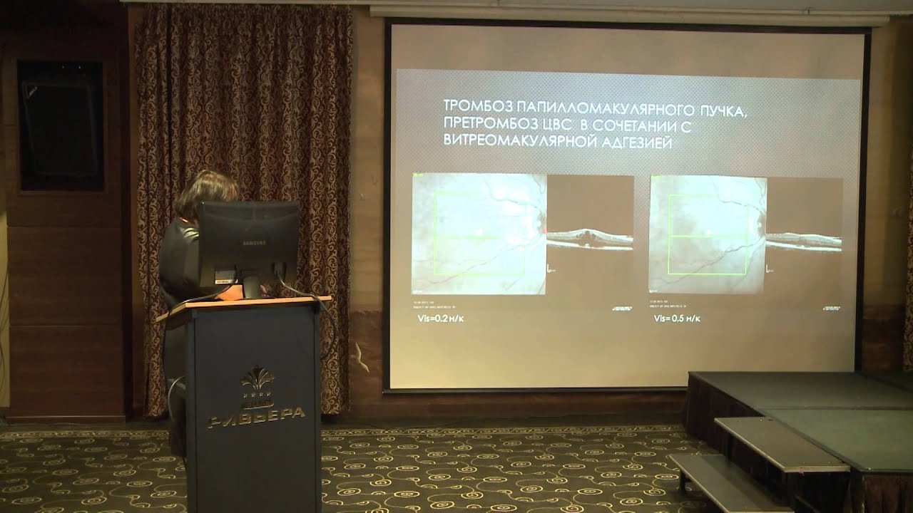 Самое лучшее средство от бородавок