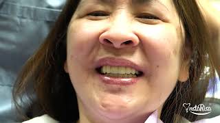 Get Started With Instarisa Your Digital Dentistry Journey