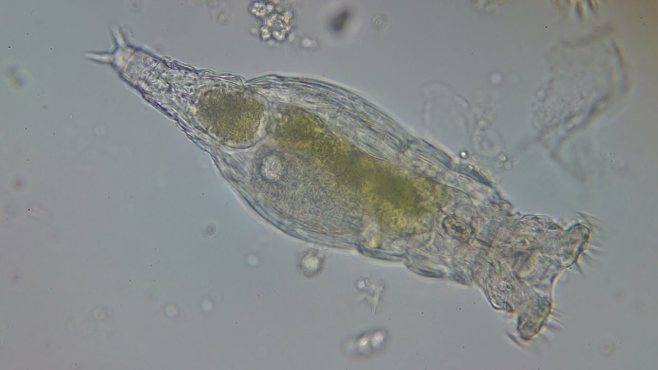 Philodina acuticornis is a species of freshwater bdelloid rotifers
