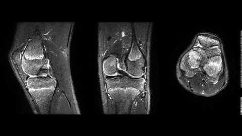 T2 Shuffling multi-planar video