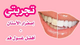 كيف تخلصت من إصفرار الأسنان للأبد ? + أفضل غسول للفم  | تجربتي الشخصية