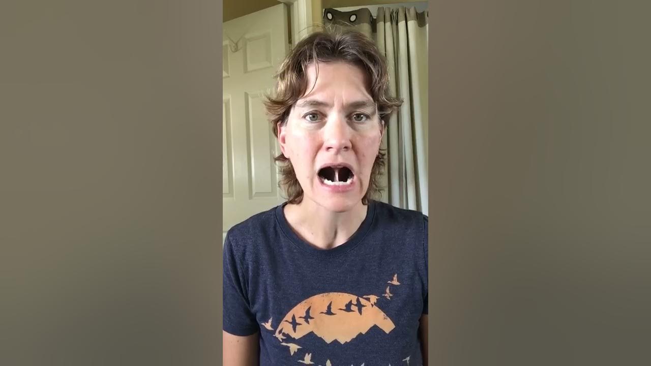 Adult tongue tie release exercises YouTube