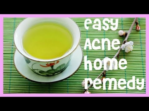 Easy Acne Home Remedy