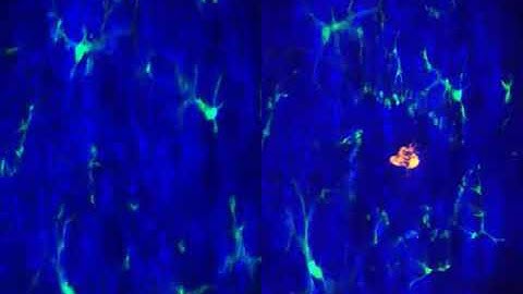 In vivo imaging of microglial cells