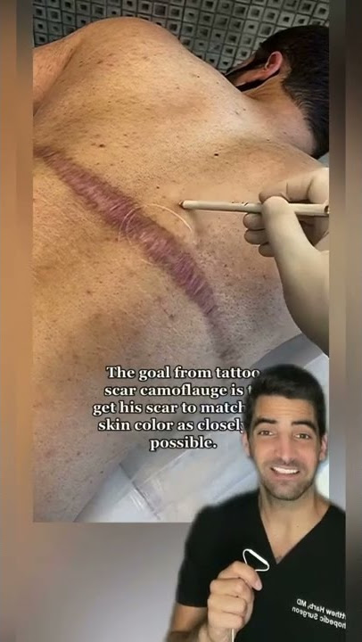 Scar Healing