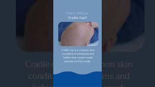 Mustela Cradle Cap Cream