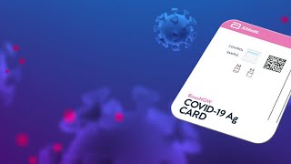 Indiana health department makes changes to COVID-19 rapid test eligibility