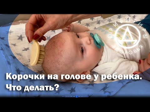 Корочки на голове у ребенка. Что делать?