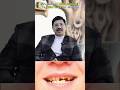 Broken Front Tooth? Watch this! Dr. Praveen Bhatia #brokentooth #teeth #dentist
