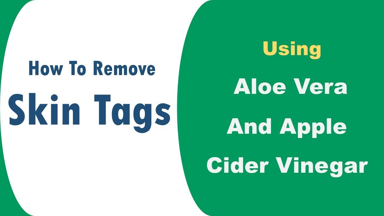 bpc 157 for acne How To Remove Skin Tags Fast: A Comprehensive Guide [JdSQ8k6gbIy]