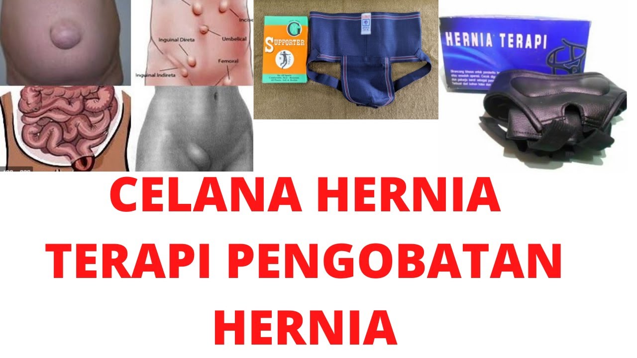 Terbongkar | Celana Hernia Terapi Pria Wanita Paling Ampuh, Cara