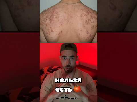 Почему нельзя есть помидоры?!