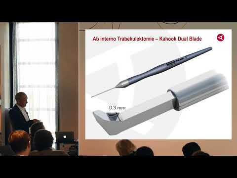 Minimalinvasive Glaukomchiurgie, Postoperatives Management. Dr. Karsten Klabe [Vortrag]