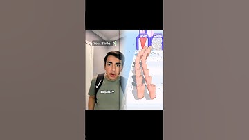 #pov You can only blink a certain amount of times #fyp