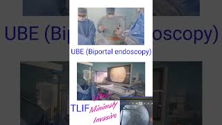 UBE TLIF by Dr Gaurav Sharma/Dr Aayush Aryal