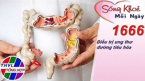 Điều trị ung thư đường tiêu hóa | Sống khỏe mỗi ngày - Kỳ 1666