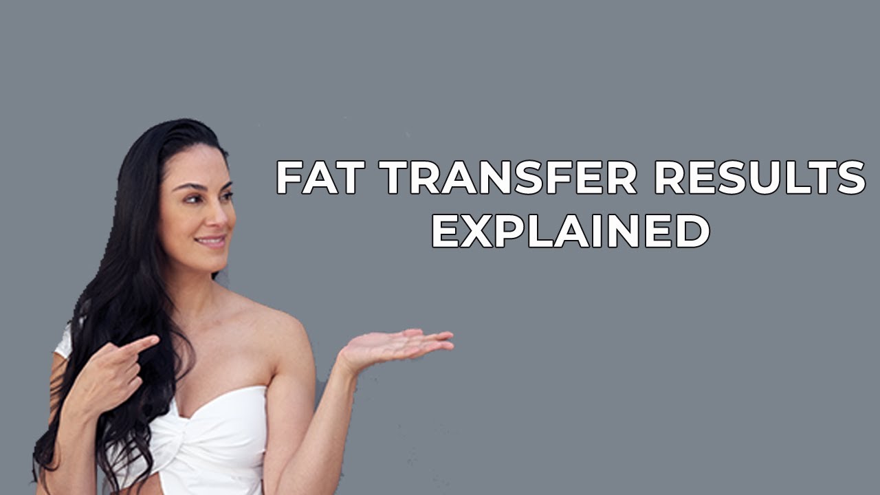 Facelift with Fat Transfer Results by Dr. Nazarian in Beverly Hills | Nazarian Plastic Surgery