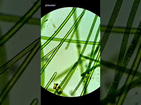 Video: Hvorfor er spirogyra en alge?