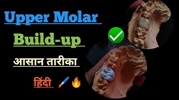 First Molar porcelain| Anatomy| Molars Build-up| Laboratory| Ceramic| Layering Ceramics| lab| India