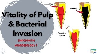 How do bacteria reach the Pulp? | Endodontic Microbiology Part I