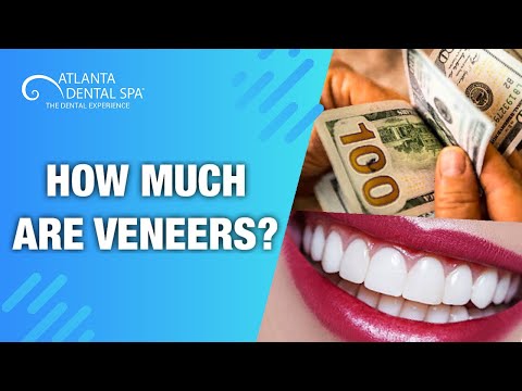 HOW MUCH DO VENEERS COST?