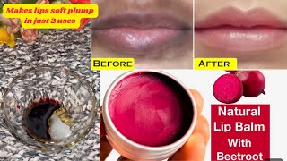 Apply this?lipbalm on dry,chapped,dark,pigmented lips to get soft pink lips? in 2days- DIY LIP BALM?