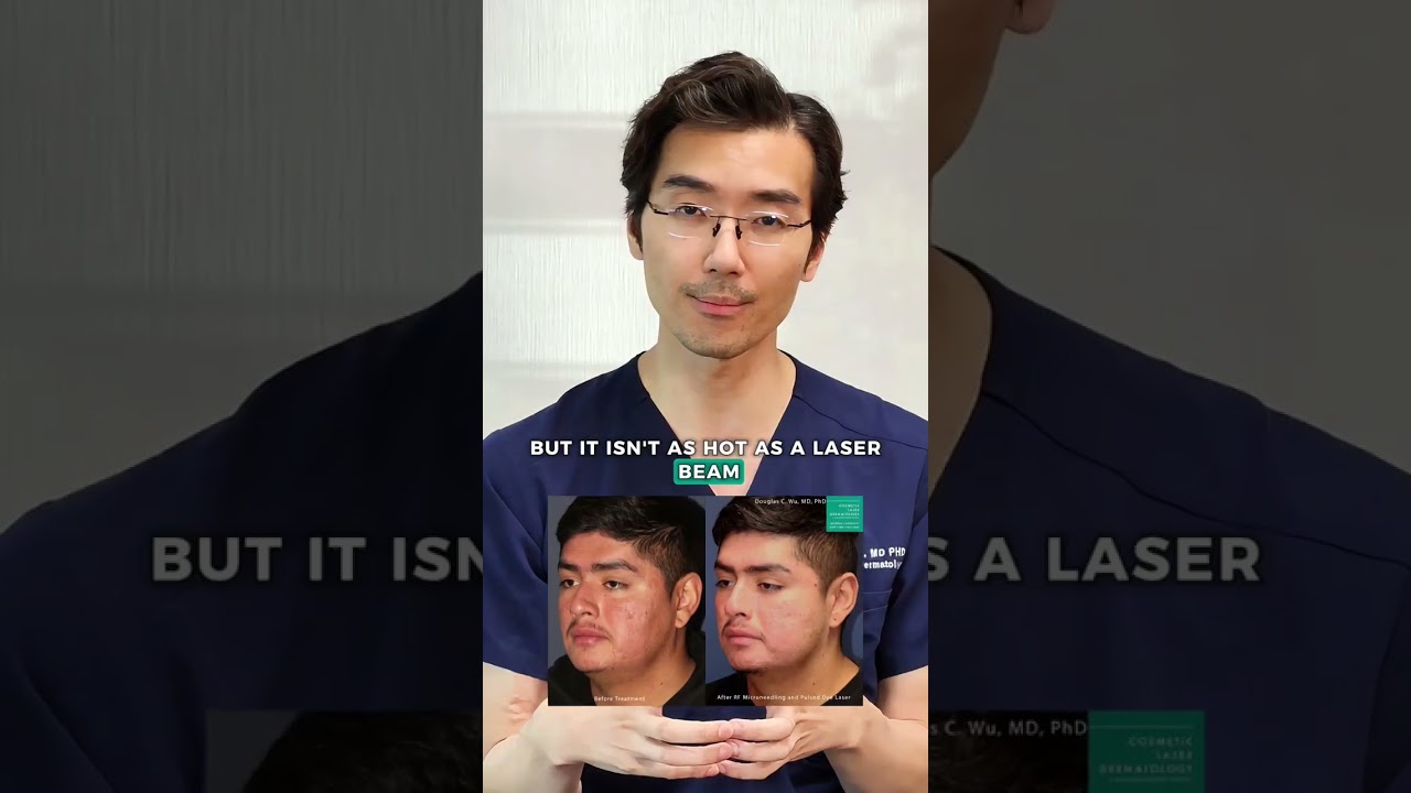 Banner for Can you treat asian skin? #Lasers