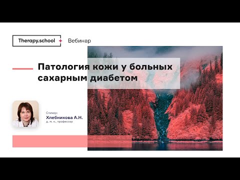 Видео: Покрытие для диабетических поставок через Medicare