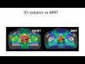 Radiotherapy for Localized Prostate Cancer