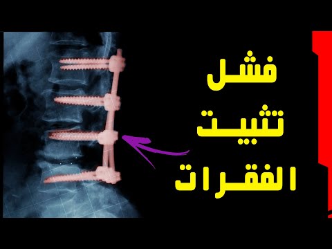 فيديو: كيف لرعاية الكلاب بعد التعقيم جراحة