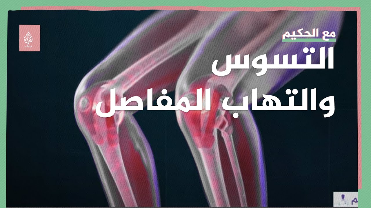 | دراسة حديثة: إهمال صحة الفم والأسنان يسبب التهاب مفاصل الروماتويدي