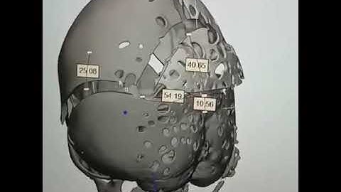3D animation Video of Human Skull