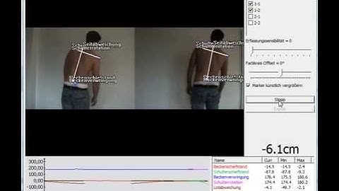 Spine Analysis with Simi Aktisys