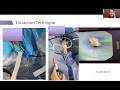 Optimizing Stone Management With Flexible and Navigable Suction Access Sheaths