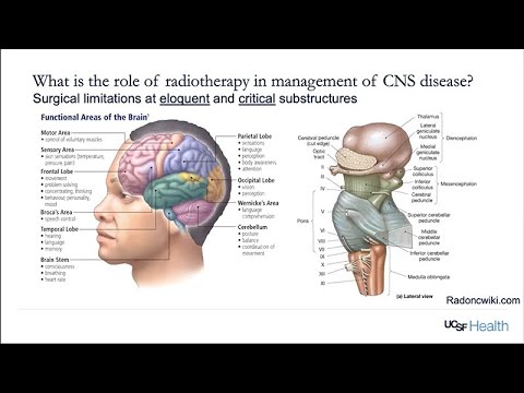 Central Nervous System Radiotherapy and Radiosurgery