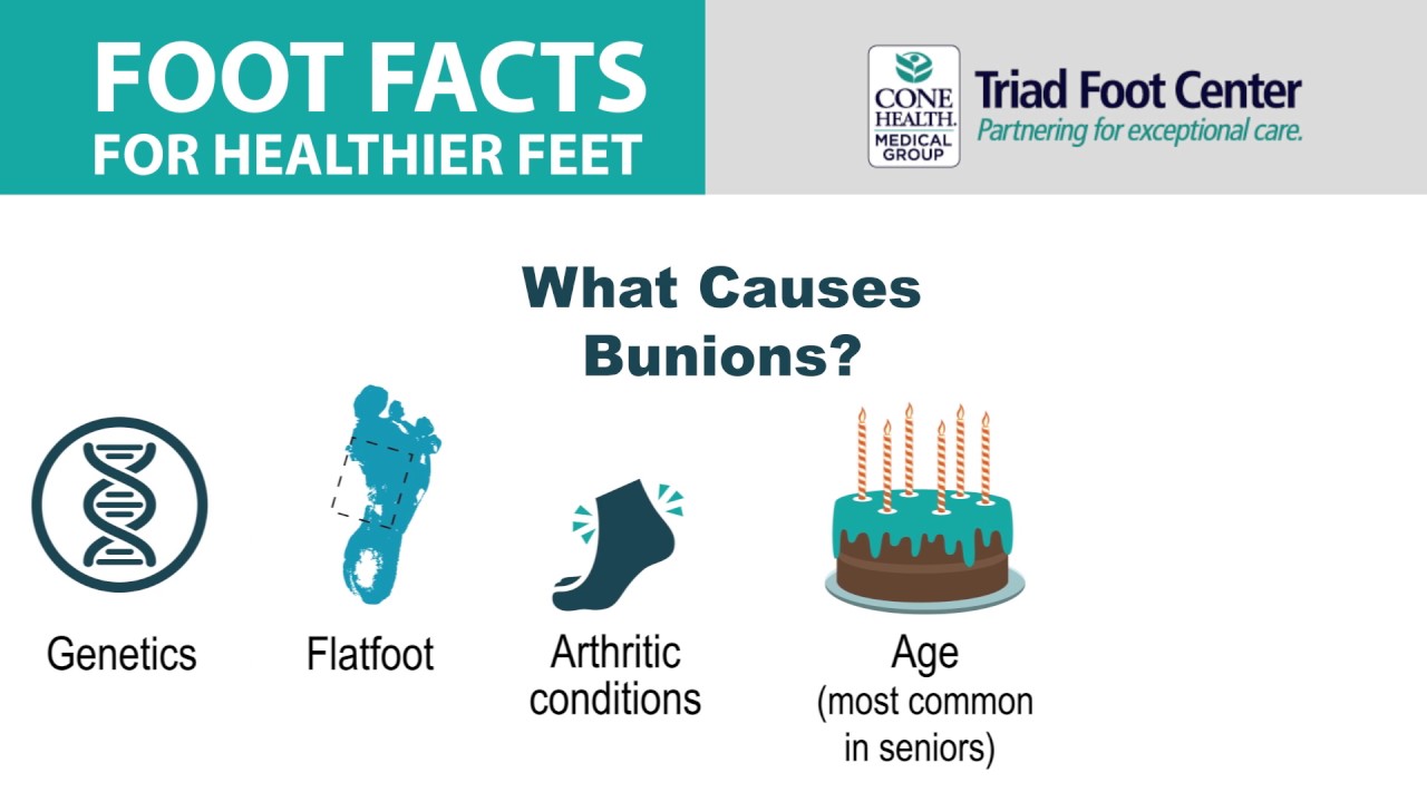 Foot Facts Bunions YouTube