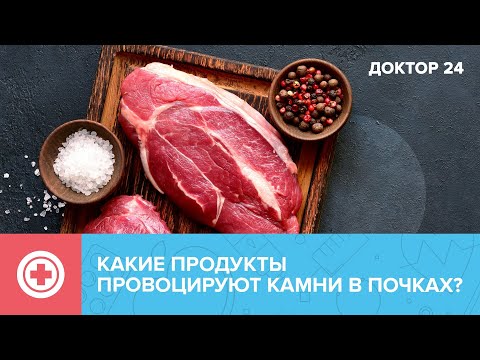 Как образуются КАМНИ в ПОЧКАХ? | Доктор 24