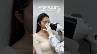 2주 만에 깐 달걀 피부가 가능해?