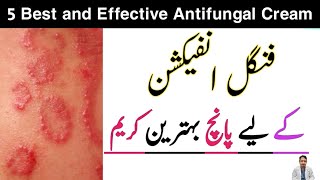 Best fungal Infection Cream (Urdu Hindi) fungal infection cream without steroids | Ringworm Cream |