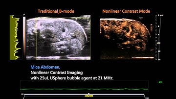 Contrast-Enhanced Ultrasound Imaging in Mice Abdomen with USphere™ Prime (on VisualSonics Vevo2100)