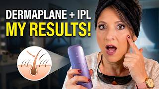 I Tried Dermaplaning Before My IPL Session: Here’s What Happened