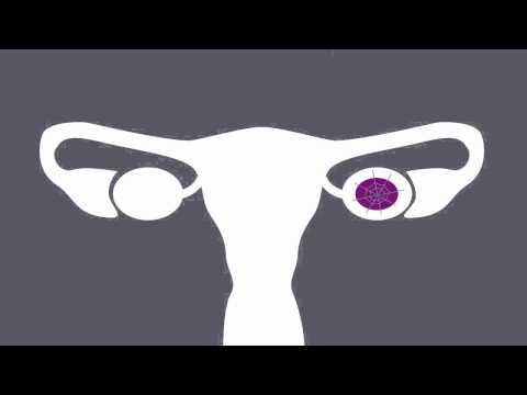 Verhütungsschirmchen erfahrungen