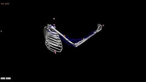 ROBOESPAS - OpenSim Upper Limb Mobilisation