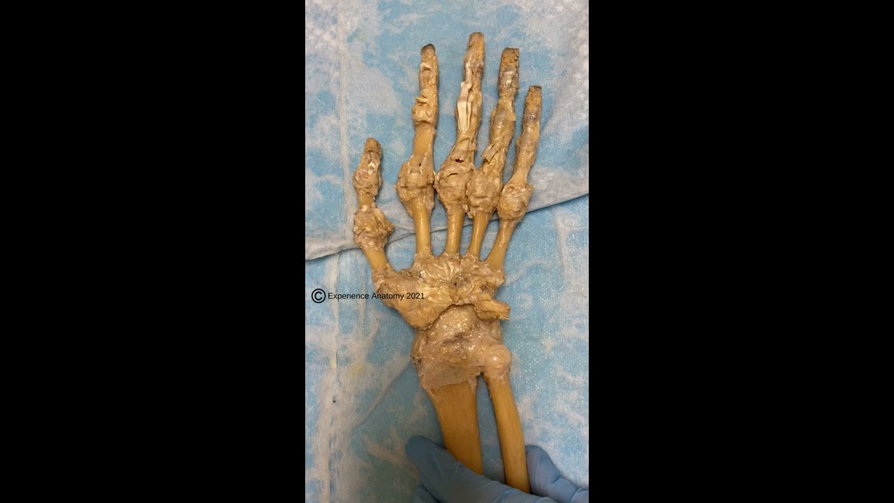 Finger Tendons