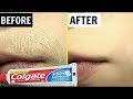 रात में इसे लगा लो सुबह तक शरीर के बाल जड़ के निचे फेल जायेगे / Remove All Unwanted Hair